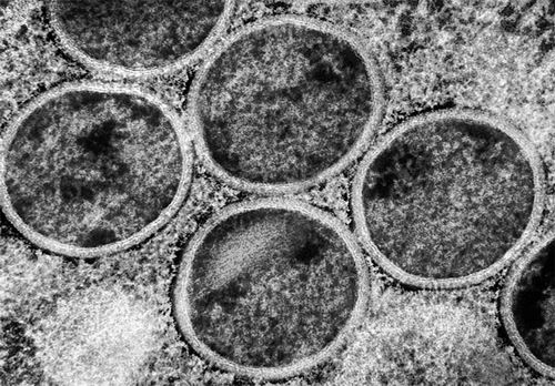 猴痘病毒进化与传播新发现：对男性生育力的潜在影响(图1)